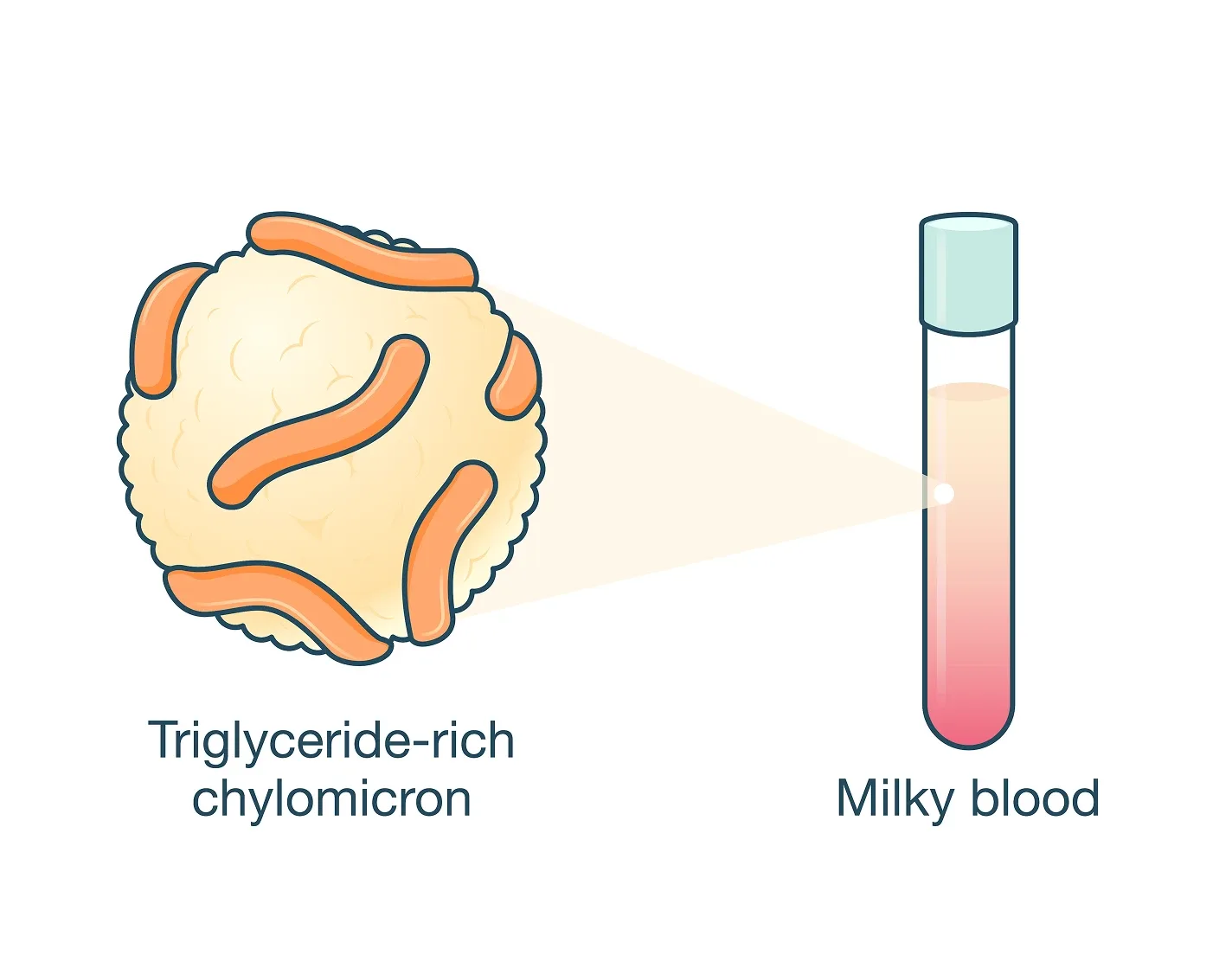 A triglyceride-rich chylomicron and milky blood